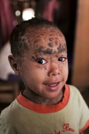 Diagnósticos extraordinarios: Mis huesos desaparecen