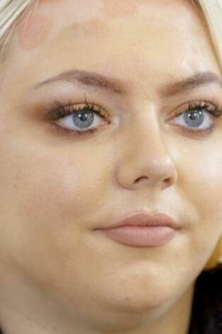 Clínica capilar: Episodio 2