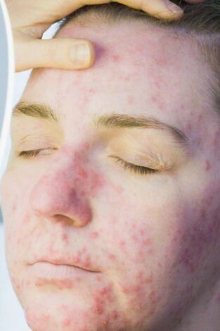 Dr. Emma: clínica dermatológica: Robert, Katie, Darren y Emma