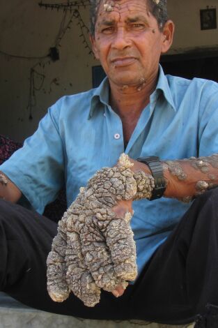 Diagnósticos extraordinarios: Episodio 4