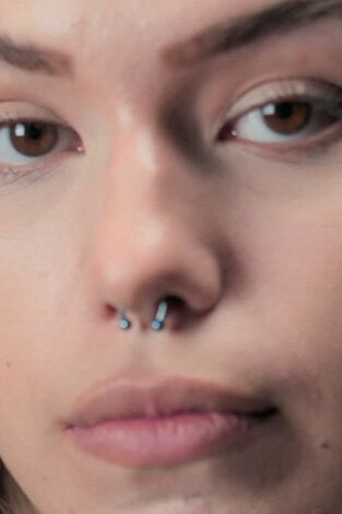 Dr. Emma: clínica dermatológica: Episodio 4