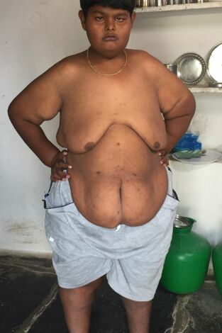 Diagnósticos extraordinarios: El chico sin ojos