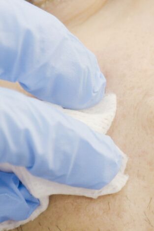 Dr. Emma: clínica dermatológica: Episodio 12