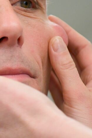 Dr. Emma: clínica dermatológica: Episodio 3