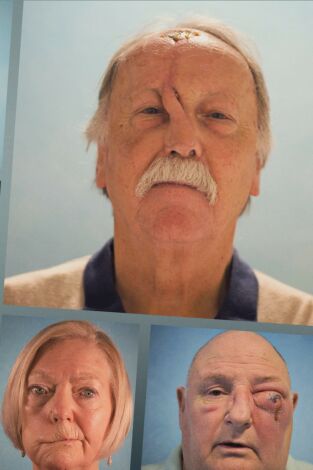 Cirugía Facial: Episodio 8