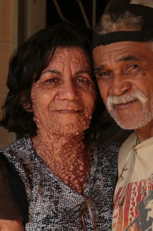 Diagnósticos extraordinarios: La mujer burbuja