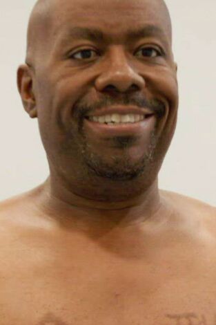 Cirugía sin anestesia: Derrick soporta sus pechos masculinos