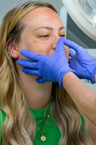 Dr. Emma: clínica dermatológica: Rostros