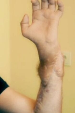 Diagnósticos extraordinarios: Los hermanos más pequeños