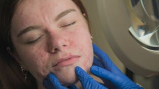 Dr. Emma: clínica dermatológica: Soy más que mi piel