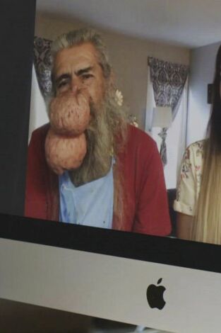 La doctora Lee, consulta virtual: Los enormes nódulos de la nariz