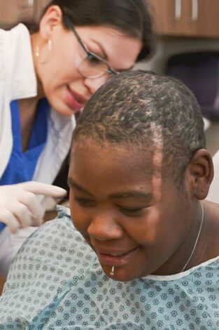 Rescate capilar: Barbie con psoriasis