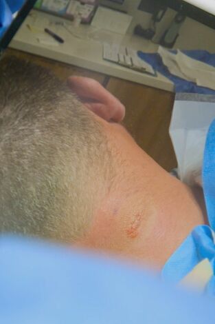 Dra. Emma: clínica dermatológica: Es mi tercer pecho