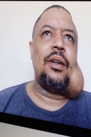 La doctora Lee, consulta virtual: Itchy, Itchy, Ya-ya, Da-da