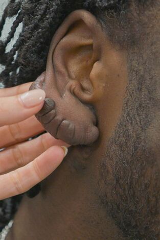 Dra. Emma: clínica dermatológica: Se lo oculté al mundo