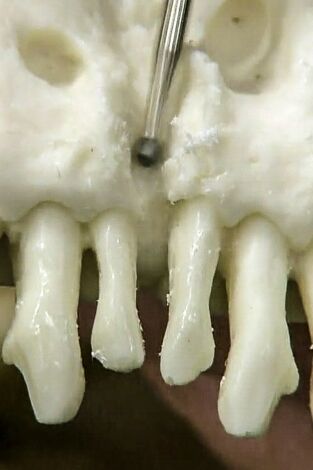 Así se hace (MAX): Réplicas de esqueletos