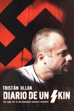 Diario de un skin