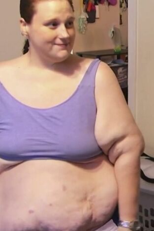 Mi vida con 300 kilos: Qué pasó después: Episodio 1