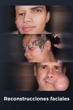 Reconstrucciones faciales (T1): Episodio 1