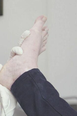 Los pies me están matando: El caballo sana