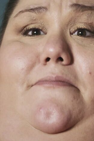 Mi vida con 300 kilos: La historia de Alicia