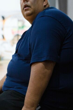 Mi vida con 300 kilos: Brasil: Welton y Marcelo
